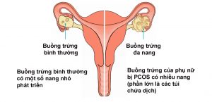 tri-rung-toc-bnx2 (2)